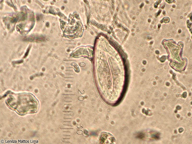 enterobius vermicularis yumurtasi goruldu secțiuni de tenă