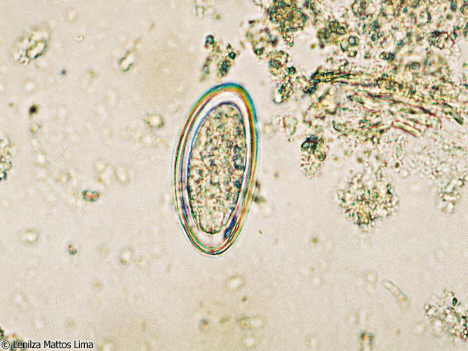 enterobius vermicularis yumurtasi goruldu fir de vierme